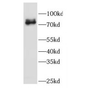 WB analysis of L02 cells, using GBE1 antibody (1/500 dilution).