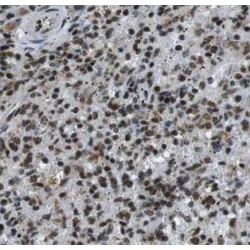 Guanylate Binding Protein 2 (GBP2) Antibody