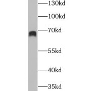 WB analysis of A375 cells, using GBP2 antibody (1/2000 dilution).
