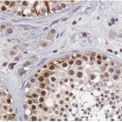 Guanylate Binding Protein 6 (GBP6) Antibody