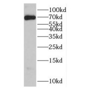 WB analysis of HeLa cells, using GBP6 antibody (1/300 dilution).