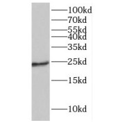 WB analysis of Y79 cells, using GCAP1 antibody (1/200 dilution).