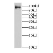 WB analysis of MCF7 cells, using GCN5 antibody (1/800 dilution).