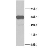 WB analysis of mouse brain tissue, using GDI1 antibody (1/1000 dilution).