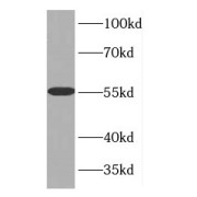 Western blot analysis of Mouse brain tissue, using GDP Dissociation Inhibitor 1 Antibody (1/1000 dilution).