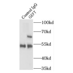 Rho Guanine Nucleotide Exchange Factor 25 / GEFT (ARHGEF25) Antibody