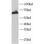 WB analysis of Mouse skeletal muscle tissue, using ARHGEF25/GEFT antibody (1/1500 dilution).