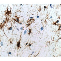 Glial Fibrillary Acidic Protein (GFAP) Antibody