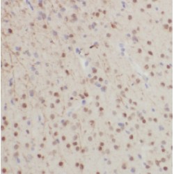 Glial Fibrillary Acidic Protein (GFAP) Antibody