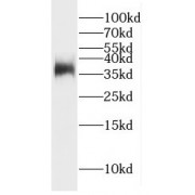 WB analysis of HepG2 cells, using GFRA2 antibody (1/1000 dilution).