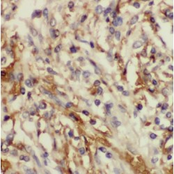 gamma-Glutamyltransferase 7 (GGT7) Antibody