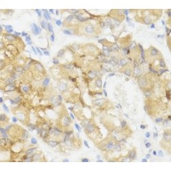 Appetite-Regulating Hormone (GHRL) Antibody