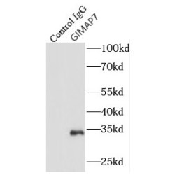 GTPase IMAP Family Member 7 (GIMAP7) Antibody