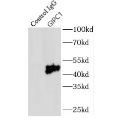 GIPC PDZ Domain Containing Family, Member 1 (GIPC1) Antibody