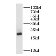WB analysis of mouse stomach tissue, using GKN2 antibody (1/1000 dilution).