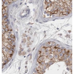 GLI3-Specific Antibody