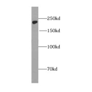 WB analysis of human placenta tissue, using GLI3-Specific antibody (1/400 dilution).