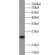 WB analysis of Transfected HEK-293 cells, using Glucagon antibody (1/500 dilution).