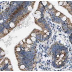 Glucose Transporter 2 / GLUT2 (SLC2A2) Antibody