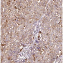 Glycine N-Acyltransferase-Like Protein 1 (GLYATL1) Antibody