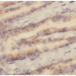 Granulocyte-Macrophage Colony-Stimulating Factor (CSF2) Antibody
