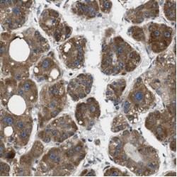 Guanine Nucleotide-Binding Protein G(I)/G(S)/G(T) Subunit Beta-3 (GNB3) Antibody