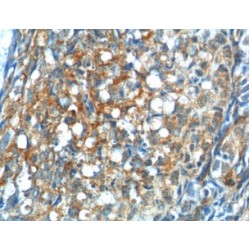Gonadotropin Releasing Hormone Receptor (GNRHR) Antibody