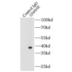Gonadotropin Releasing Hormone Receptor (GNRHR) Antibody