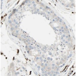 Golgin Subfamily A Member 2 (GOLGA2) Antibody