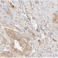 Golgi-Associated PDZ And Coiled-Coil Motif-Containing Protein (GOPC) Antibody