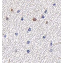 Complement C1q Tumor Necrosis Factor-Related Protein 5 (GP repeat) Antibody