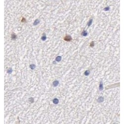Complement C1q Tumor Necrosis Factor-Related Protein 5 (GP repeat) Antibody