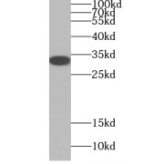 WB analysis of recombinant proteins containing the GP repeat sequence, using GP repeat antibody (1/1000 dilution).