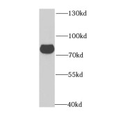 WB analysis of mouse skeletal muscle tissue, using GPD2 antibody (1/1000 dilution).