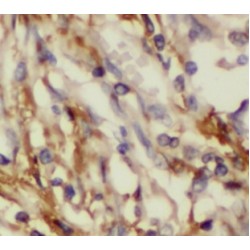Glucose-6-Phosphate Isomerase (GPI) Antibody