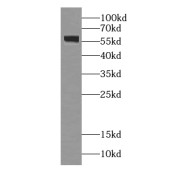 WB analysis of HEK-293 cells, using GPR101-Specific antibody (1/300 dilution).