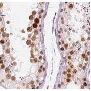 IHC-P analysis of human testis tissue, using GPR123-Specific Antibody (1/50 dilution).