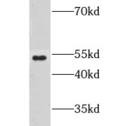 WB analysis of SH-SY5Y cells, using GPR142 antibody (1/500 dilution).
