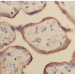 G Protein Coupled Receptor 161 (GPR161) Antibody