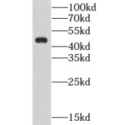 WB analysis of mouse brain tissue, using GPR22 antibody (1/300 dilution).