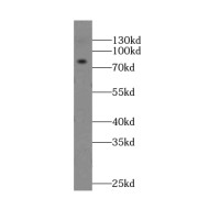 WB analysis of human brain tissue, using GPRIN3-Specific antibody (1/500 dilution).