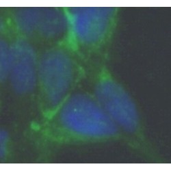 Glutathione Peroxidase 3 (GPX3) Antibody
