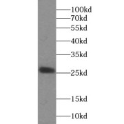 WB analysis of HEK-293 cells, using GPX3 antibody (1/500 dilution).