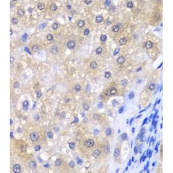 Glutathione Peroxidase 4 (GPX4) Antibody