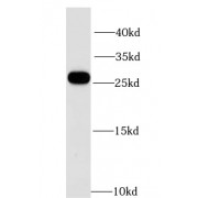 WB analysis of mouse kidney tissue, using GPX4 antibody (1/1000 dilution).