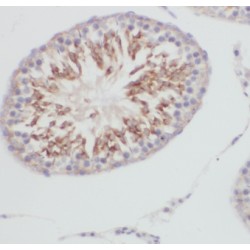 Glutathione Peroxidase 5 (GPX5) Antibody