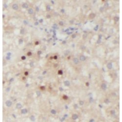 Rho GTPase-Activating Protein 26 (ARHGAP26) Antibody