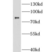 WB analysis of A549 cells, using GRAMD1B antibody (1/1000 dilution).