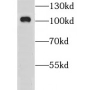 WB analysis of rat brain tissue, using GRIA4 antibody (1/600 dilution).