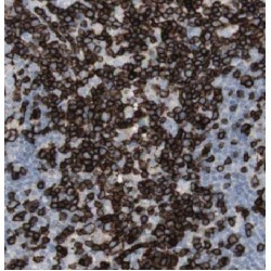 Beta-Adrenergic Receptor Kinase 1 (GRK2) Antibody